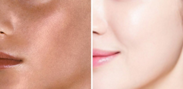 Skin Whitening Tips