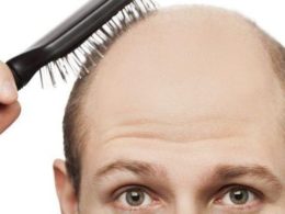 hair transplant